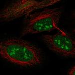 LRWD1 Polyclonal Antibody