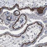 PEG10 Polyclonal Antibody