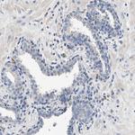 PEG10 Antibody in Immunohistochemistry (IHC)