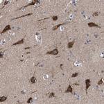 C9orf135 Polyclonal Antibody