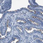 C9orf171 Antibody in Immunohistochemistry (IHC)