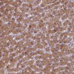 BAAT Polyclonal Antibody