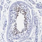 INSL6 Polyclonal Antibody