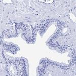 INSL6 Antibody in Immunohistochemistry (IHC)