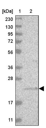 INSL6 Antibody in Western Blot (WB)