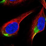 ADAMTS3 Polyclonal Antibody