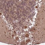 ADAMTS3 Polyclonal Antibody