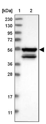 MKS1 Antibody in Western Blot (WB)