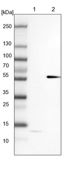 MKS1 Antibody in Western Blot (WB)
