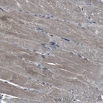 SLC38A10 Antibody in Immunohistochemistry (Paraffin) (IHC (P))