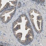 BLOC1S1 Polyclonal Antibody