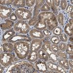 BLOC1S1 Antibody in Immunohistochemistry (IHC)