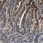 BLOC1S1 Antibody in Immunohistochemistry (IHC)