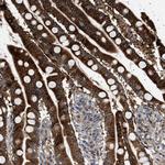 FICD Antibody in Immunohistochemistry (Paraffin) (IHC (P))