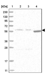 FICD Antibody in Western Blot (WB)