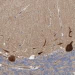 LRSAM1 Polyclonal Antibody