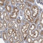 VSTM2A Polyclonal Antibody