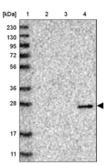 VSTM2A Antibody in Western Blot (WB)