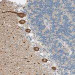 PTGES3L-AARSD1 Polyclonal Antibody