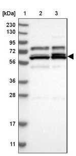 PTGES3L-AARSD1 Antibody in Western Blot (WB)