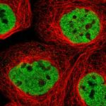 PHF12 Polyclonal Antibody