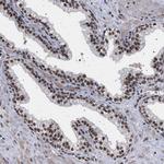 PHF12 Antibody in Immunohistochemistry (Paraffin) (IHC (P))