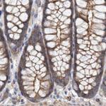NSP5 Antibody in Immunohistochemistry (IHC)