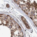 NSP5 Antibody in Immunohistochemistry (IHC)