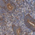 NSP5 Antibody in Immunohistochemistry (IHC)