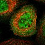 SH3GLB2 Polyclonal Antibody