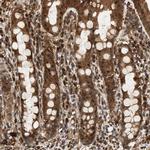 SH3GLB2 Antibody in Immunohistochemistry (IHC)