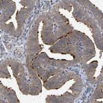 C9orf116 Antibody in Immunohistochemistry (IHC)
