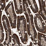 ZBTB26 Antibody in Immunohistochemistry (Paraffin) (IHC (P))