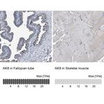 Adenylate Kinase 8 Antibody