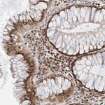 ATXN7L1 Polyclonal Antibody