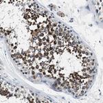 PRTFDC1 Antibody in Immunohistochemistry (Paraffin) (IHC (P))