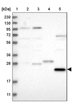 PRTFDC1 Antibody in Western Blot (WB)