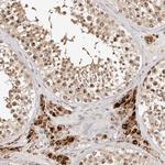 SEC14L1 Polyclonal Antibody