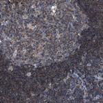 SMAP2 Polyclonal Antibody