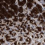 HSD17B14 Polyclonal Antibody