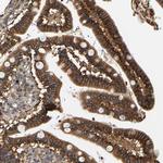 FAM78A Polyclonal Antibody