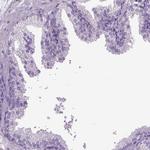 C9orf117 Antibody in Immunohistochemistry (IHC)