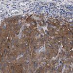 GMPR Antibody in Immunohistochemistry (IHC)