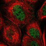 WIPI2 Polyclonal Antibody