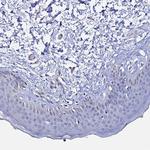 APOBEC3H Antibody in Immunohistochemistry (Paraffin) (IHC (P))