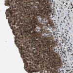 RBM33 Polyclonal Antibody