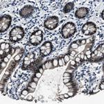 DUSP19 Polyclonal Antibody