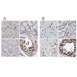 SFRS15 Antibody in Immunohistochemistry (IHC)