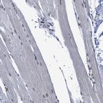 SFRS15 Antibody in Immunohistochemistry (IHC)