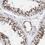 SFRS15 Antibody in Immunohistochemistry (IHC)
